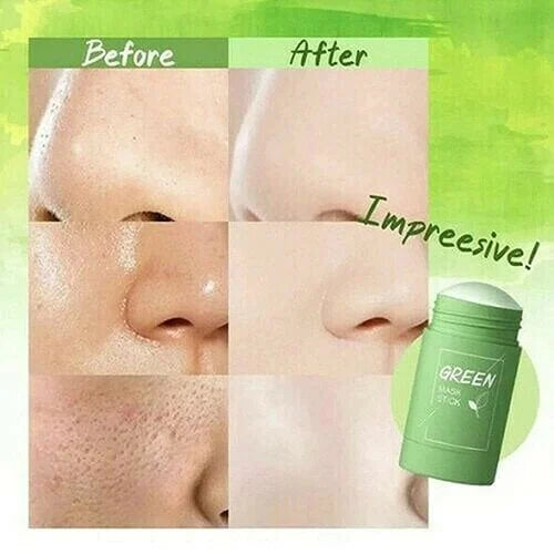 GreenTeaMask™ - Effektive Reinigung der Hautporen